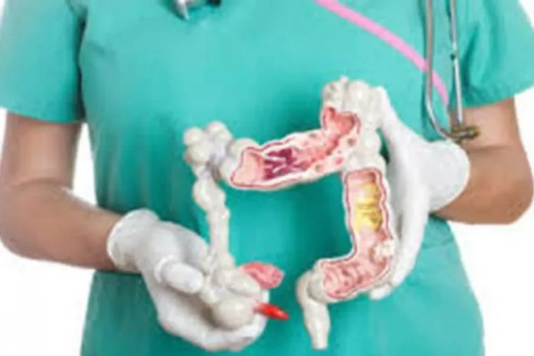 Usus